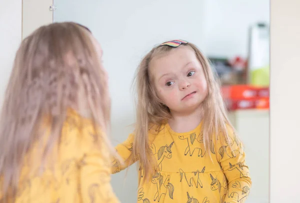 Синдром Дауна Маленької Дівчинки Інвалідність Дитини Генетична Психіатрична Хвороба Додаткова — стокове фото