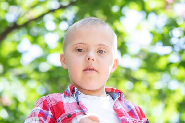 Retrato Menino Com Síndrome Criança Com Deficiência Uma Criança Com — Fotografia de Stock