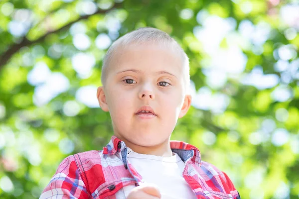 Ritratto Ragazzo Con Sindrome Bambino Disabile Bambino Con Una Malattia — Foto Stock