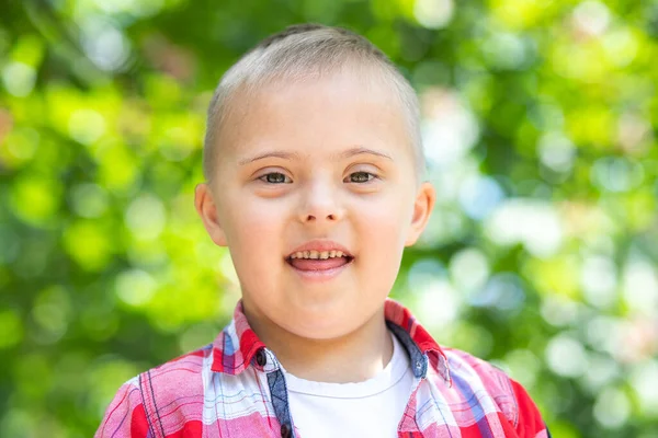 Portret Van Een Jongen Met Het Syndroom Van Gehandicapt Kind — Stockfoto