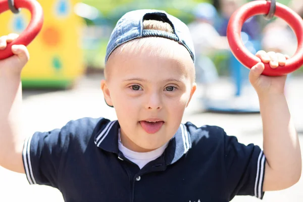 Niño Con Síndrome Juega Patio Recreo Niño Con Discapacidad Niño — Foto de Stock