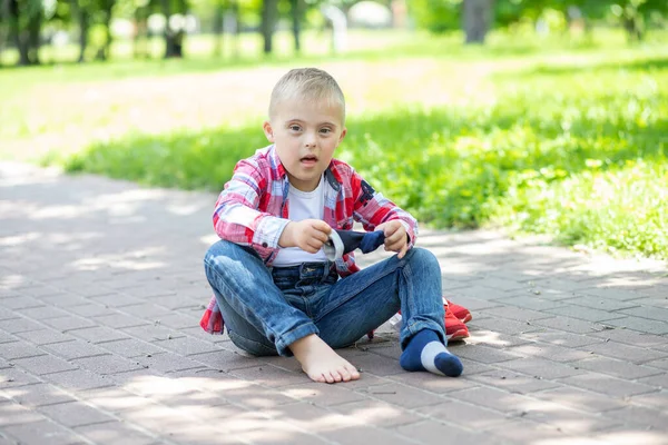 Портрет Хлопчика Синдромом Дауна Інваліда Дитини Генетичною Хромосомною Хворобою — стокове фото