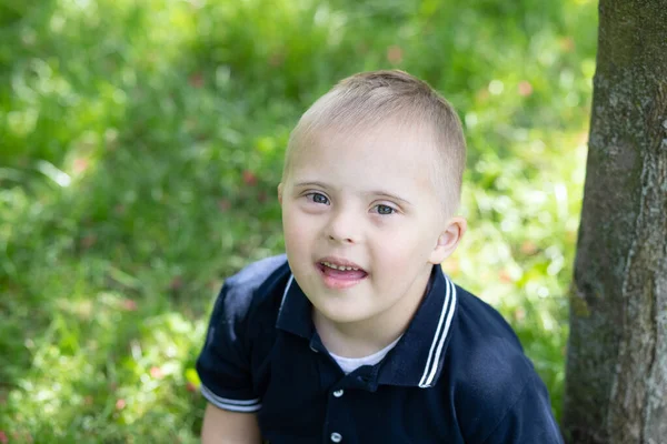 Ritratto Ragazzo Con Sindrome Bambino Disabile Bambino Con Una Malattia — Foto Stock