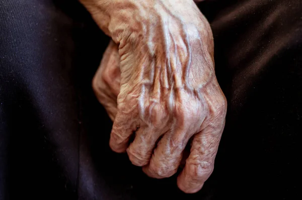 Mãos Avó Estão Enrugadas Mãos Velhas Pensionista Veias Pele Velhice — Fotografia de Stock