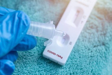 Covid-19 Antikor test kiti kullanılarak nazofaringeal örnek sıvısı bırakılıyor..