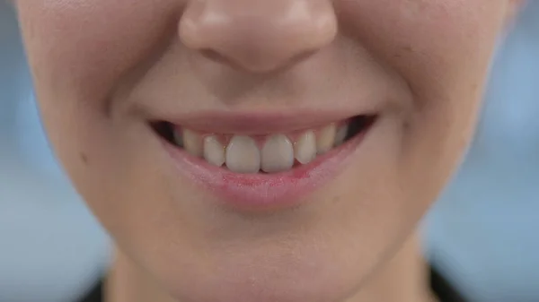 Primo piano di labbra e denti di donna sorridente — Foto Stock