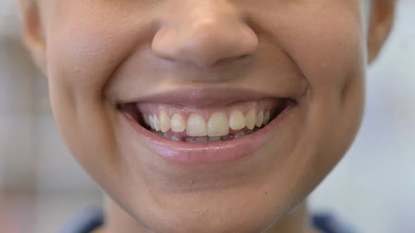 Рот африканської жінки з зубним болем — стокове фото