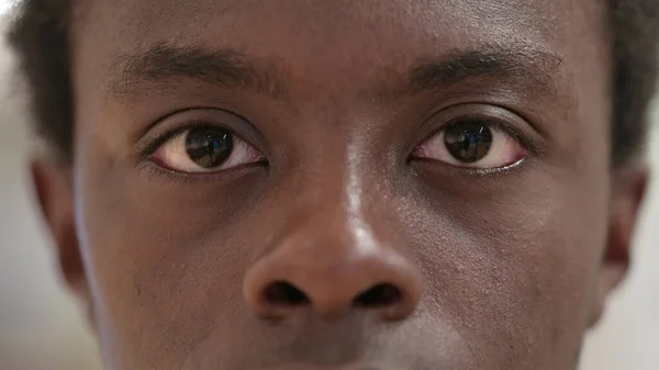 Olhos cintilantes Jovem Africano Olhando para a câmera — Fotografia de Stock