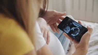 Anneliğin mutluluğu, akıllı telefondan gelecekteki bebeğin ultrason görüntüsüne bakan iki kadın. Eşcinsel hamile lezbiyen çift. Tüp bebek, LGBT Gurur Ayı, ilişki, doğum, konsept.