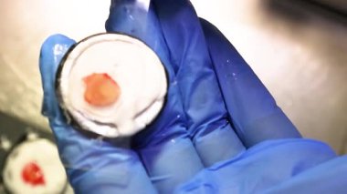 Laboratuvar teknisyeni mikroskobik çalışma için insan dokusu yerleştiriyor.