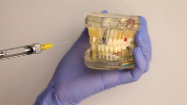 Anestezi enjeksiyonunun makro görünümü, diş hekimliğinde kontrol edilen hassas yönetimi ve klinik iş akışını vurgulayan şeffaf çene modelinin iğne delici sakızını gösteriyor