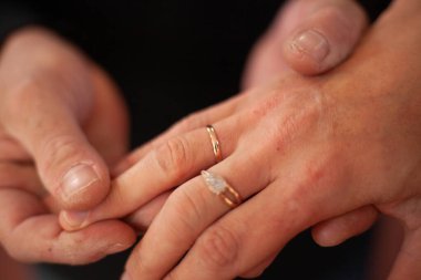 Parmağında evlilik yüzüğü var.