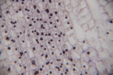 Mikroskobik görüntü, karanlık dairesel hücreleri olan bitki dokusunu ve hücre yapısını ve organizasyonunu vurgulayan, ızgara şeklinde düzenlenmiş ışık hücre duvarlarını gösteriyor.