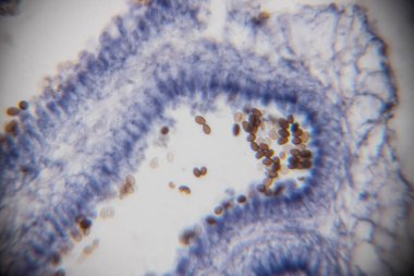 Mavi lekeli biyolojik dokunun mikroskobik görüntüsü, beyaz arkaplanda kavisli bir düzende hücresel yapılar ve kahverengi tanecikleri gösteriyor.