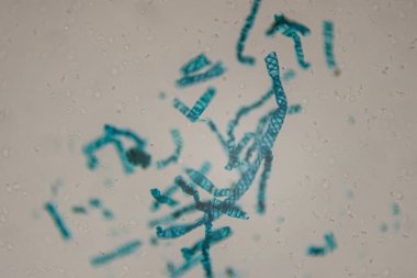 Mikroskobik resim mavi-yeşil iplikleri ve şekilleri kabarcıklar ve bulanık arkaplan oluşturan berrak sıvı içinde asılı şekilleri soyut görsel efekt