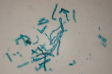 Bükülmüş şekilleri ve desenleri olan mavi DNA iplikleri, küçük su damlacıkları ile hafif bir arka planda yüzer ve genetiğin bilimsel bir görsel temsilini oluşturur.