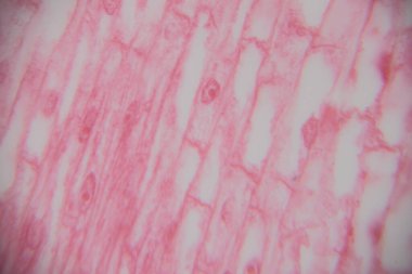 Genişletilmiş hücreleri ve hücresel boşlukları gösteren pembe bitki dokusunun mikroskobik görüntüsü ve bilimsel çalışma ve analiz için hafif bir arka plan ve yumuşak odak