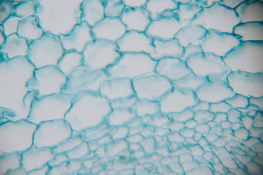 Close-up view of textured bubbles with blue tint against a white background, highlighting fluid dynamics and artistic patterns in a captivating visual display