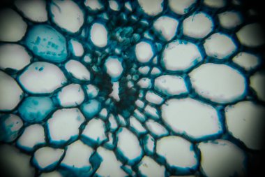 Bitki hücrelerinin detaylı mikroskobik görüntüsü, doğal yapıların karmaşıklığını gösteren canlı renkler ve desenlerle eşsiz şekiller ve dokular ortaya çıkarıyor.