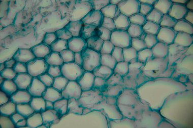 Mikroskop altında bitki hücrelerinin yakın çekimleri, ayrıntılı bal peteği desenlerini ve canlı mavi renkleri ortaya çıkararak, hücresel yapıların ve biyolojik maddelerin karmaşıklığını göstermektedir.