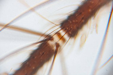 Böcek anatomisinin detaylı görüntüleri, büyütme altında ince saç benzeri yapıların ve dokuların vurgulanması, biyolojik formların karmaşıklığını gözler önüne seriyor.