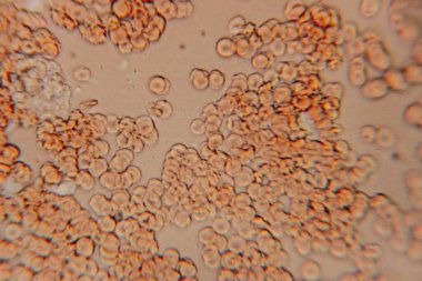 Mikroskop altında dairesel hücrelerin yakın plan çekimleri, kırmızımsı renkler ve benzersiz dokular, laboratuvar ortamında biyolojik yapıları vurguluyor.