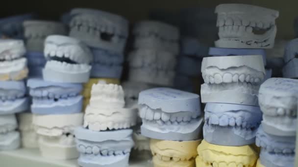 Aufbewahrungsort von Gipsmodellen menschlicher Kiefer in einer kieferorthopädischen Klinik. Kontrolle und diagnostische Zahnabdrücke