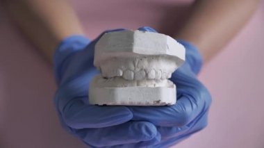Parantez sistemini kurmadan önce dişlerin alçıtaşı modeli. Doktor eldiven kapalı ve kişinin çiğneme aparatı, çene alçı kalıpları açar