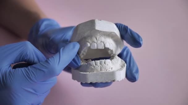 Gesso della mascella superiore e inferiore nelle mani di un ortodontista. Il dentista indica un problema dentale sul gesso superiore della mascella. Primo piano — Video Stock