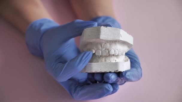 Gips-3-d-Modell für den Zahnarzt, zur Behandlung und Inspektion von Zähnen und Zahnspangen — Stockvideo