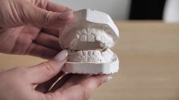 Гипсовая модель зубов перед установкой кронштейновой системы. Врач-ортодонт закрывает и открывает гипсовые слепки челюсти, жевательного аппарата человека — стоковое видео