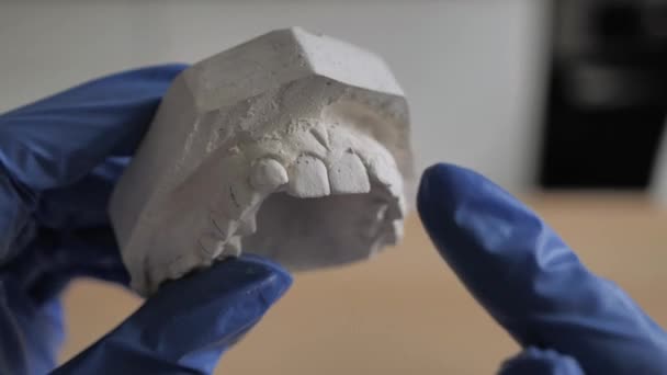 Le plâtre modèle 3 d du maxillaire dans les mains d'un orthodontiste en gants bleus. Main tenir rotation des dents, coulée de gypse dentaire — Video