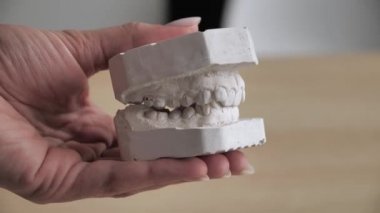 Kadın ellerinde alçı var. Doktor çene alçı kalıpları kapatır ve açar, kişinin çiğneme aygıtı