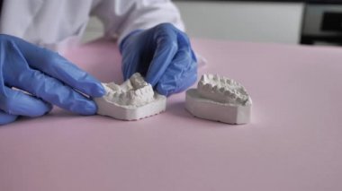 Eldivenli doktorlar diş çene alçı sorununu gösterir
