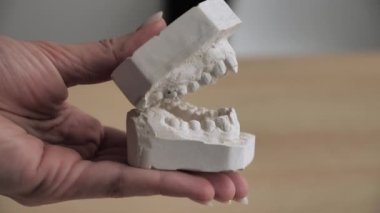 Parantez sistemini kurmadan önce dişlerin alçıtaşı modeli. Mavi eldivenli doktor ortodontist çenenin alçı kalıplarını açar, kişinin çiğneme aparatını. Yan görünüm