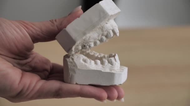 Modelo de gesso dos dentes antes de instalar o sistema de suporte. Médico ortodontista em luvas azuis fecha e abre os moldes de gesso da mandíbula, o aparelho de mastigação da pessoa. Vista lateral — Vídeo de Stock