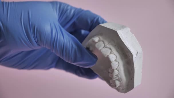 Modello in gesso dell'impronta della mascella dentale superiore — Video Stock