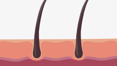 Saç uzatmak için saç serumu uygulanıyor. 4K animasyon, daha kalın saç.