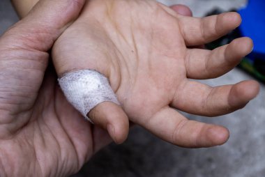 Çocuğun yara bandı ile kapatılmış bir yarası var. Yaralı çocuk.