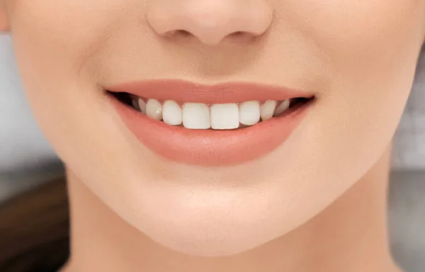 Woman with beautiful smile and white teeth in dentist. — Stock Photo, Image