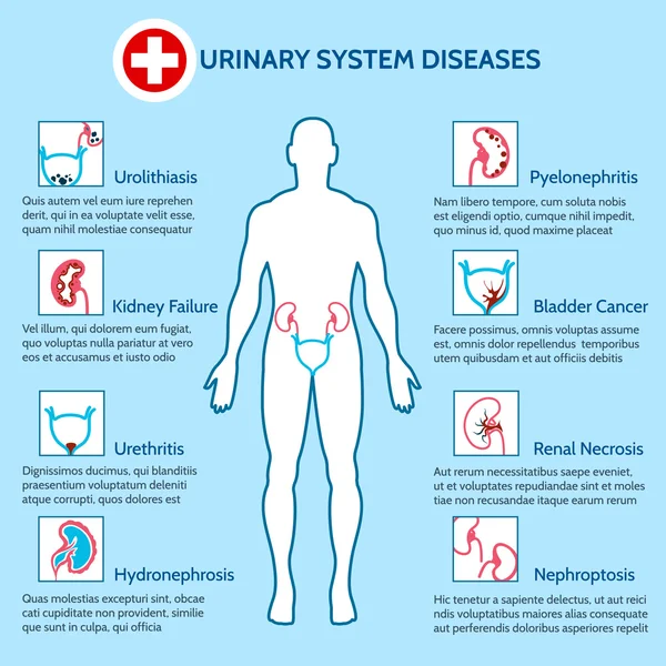 Enfermedades del sistema urinario — Vector de stock