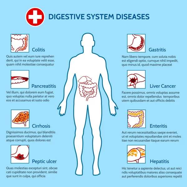Doenças do Sistema Digestivo Humano — Vetor de Stock
