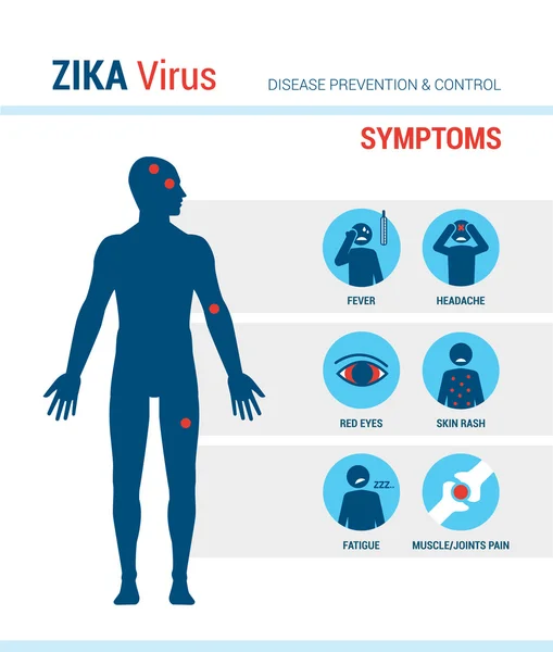 Infografías de los síntomas del virus del Zika — Vector de stock