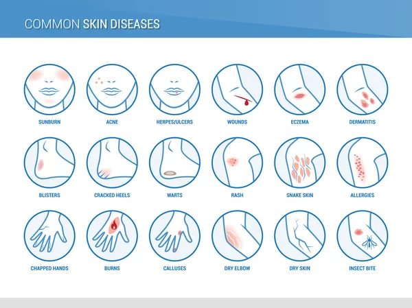 Kožní nemoci ikony — Stockový vektor