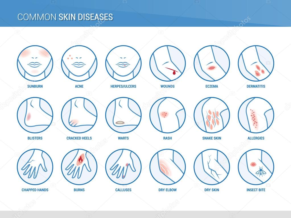 Skin diseases icons