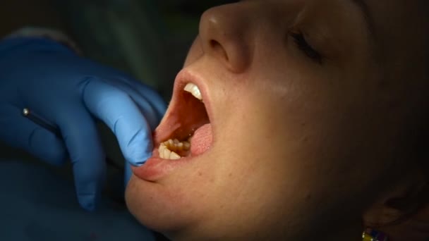 Borstar tänderna på en mottagning hos tandläkaren — Stockvideo