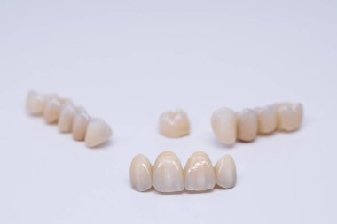 Metal Free Ceramic Dental Crowns. Ceramic zirconium in final version. Staining and glazing. Precision design and high quality materials clipart