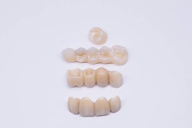 Metalsiz seramik diş kaplaması. Metalsiz porselenlerle dolu uzun zirkon köprüsü. Dişçinin ofisinde yapılan güzel seramik dişler.