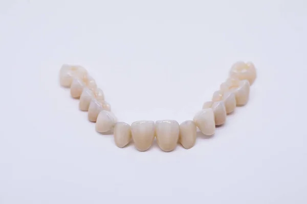 Metal Free Ceramic Dental Crowns. Ceramic zirconium in final version. Staining and glazing. Precision design and high quality materials. — Stock Photo, Image