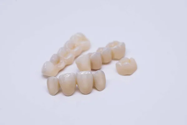 Coronas dentales de cerámica sin metal. Puente dental aislado en wite fabricado en porcelana cerámica. Restauración estética de la pérdida dental. Circonio cerámico — Foto de Stock